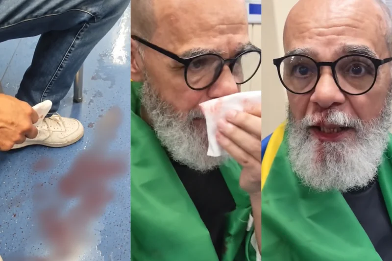 Vídeo mostra idoso ferido em vagão de metrô em São Paulo